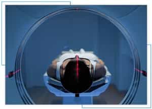 Migraine/Headaches Treatment at Specialty Family Medicine Located in Boca Raton, FL