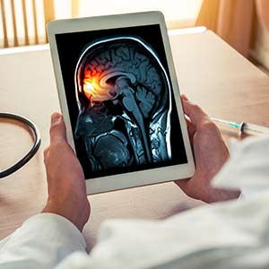 Migraines Treatment at Specialty Family Medicine in Boca Raton, FL