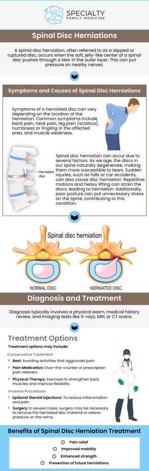 A herniated disc occurs when the soft, inner part of a spinal disc pushes through a tear in the outer layer, putting pressure on nearby nerves. Symptoms include localized back or neck pain, radiating pain to the arms or legs, and numbness or tingling in the affected area. In severe cases, it may also cause weakness and difficulty with movement. At Specialty Family Medicine, our team offers personalized care to manage symptoms and help improve your mobility. For more information, contact us today or schedule an appointment online. We are conveniently located at 1599 NW 9th Ave, Suite 4, Boca Raton, FL 33486. A herniated disc occurs when the soft, inner part of a spinal disc pushes through a tear in the outer layer, putting pressure on nearby nerves. Symptoms include localized back or neck pain, radiating pain to the arms or legs, and numbness or tingling in the affected area. In severe cases, it may also cause weakness and difficulty with movement. At Specialty Family Medicine, our team offers personalized care to manage symptoms and help improve your mobility. For more information, contact us today or schedule an appointment online. We are conveniently located at 1599 NW 9th Ave, Suite 4, Boca Raton, FL 33486.