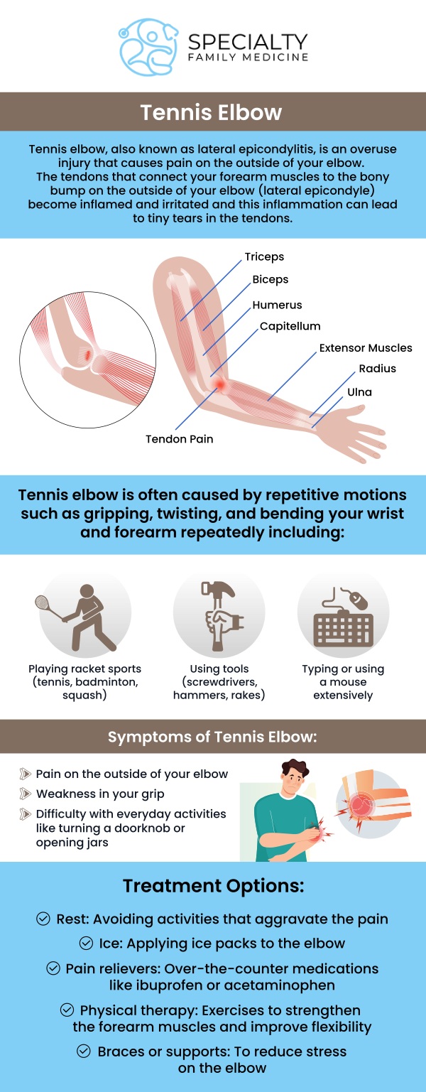Common questions asked by patients: What is tennis elbow? What causes tennis elbow? What are the symptoms of tennis elbow? How is tennis elbow diagnosed? What are the treatment options for tennis elbow? Tennis elbow is a painful condition caused by overuse of the forearm muscles, leading to inflammation in the elbow. At Specialty Family Medicine, our medical team offers personalized treatment options to relieve pain and promote healing. For more information, contact us today or schedule an appointment online. We are conveniently located at 1599 NW 9th Ave, Suite 4, Boca Raton, FL 33486. We serve patients from Boca Raton FL, Highland Beach FL, Lighthouse Point FL, Kings Point FL, Delray Beach FL, Deerfield Beach FL, Boynton Beach FL, and surrounding areas. Common questions asked by patients: What is tennis elbow? What causes tennis elbow? What are the symptoms of tennis elbow? How is tennis elbow diagnosed? What are the treatment options for tennis elbow?
Tennis elbow is a painful condition caused by overuse of the forearm muscles, leading to inflammation in the elbow. At Specialty Family Medicine, our medical team offers personalized treatment options to relieve pain and promote healing. For more information, contact us today or schedule an appointment online. We are conveniently located at 1599 NW 9th Ave, Suite 4, Boca Raton, FL 33486. We serve patients from Boca Raton FL, Highland Beach FL, Lighthouse Point FL, Kings Point FL, Delray Beach FL, Deerfield Beach FL, Boynton Beach FL, and surrounding areas.